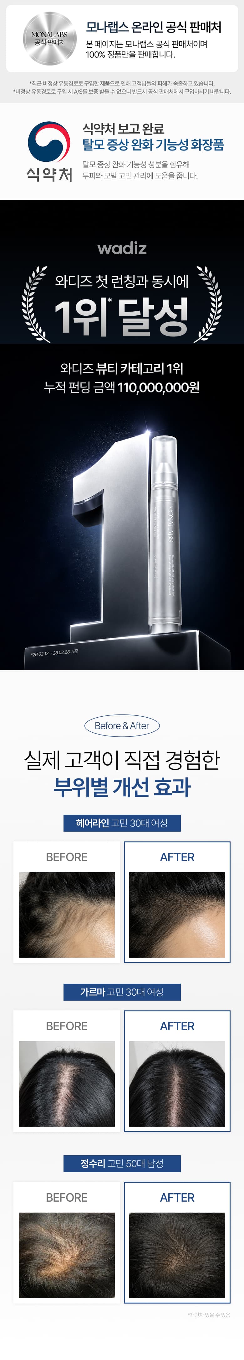 탈모앰플 상세페이지